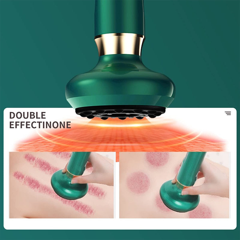 Vacuum Cupping Massager